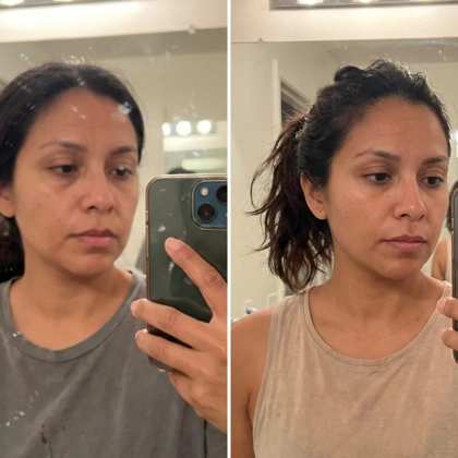 Antes y después